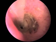 close up of eardrum